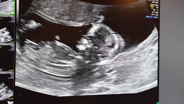 Please guess the gender by the scan