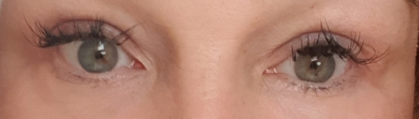 Under eye wrinkles - where the hell did they come from?