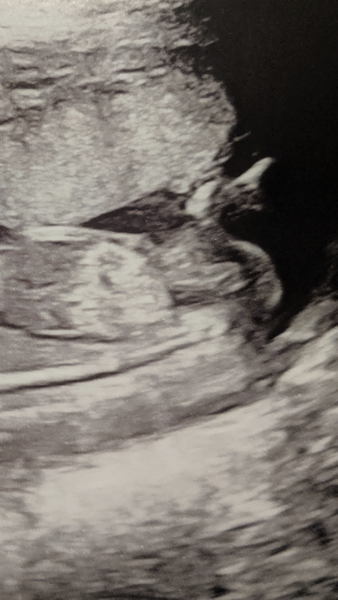 March Babies #3