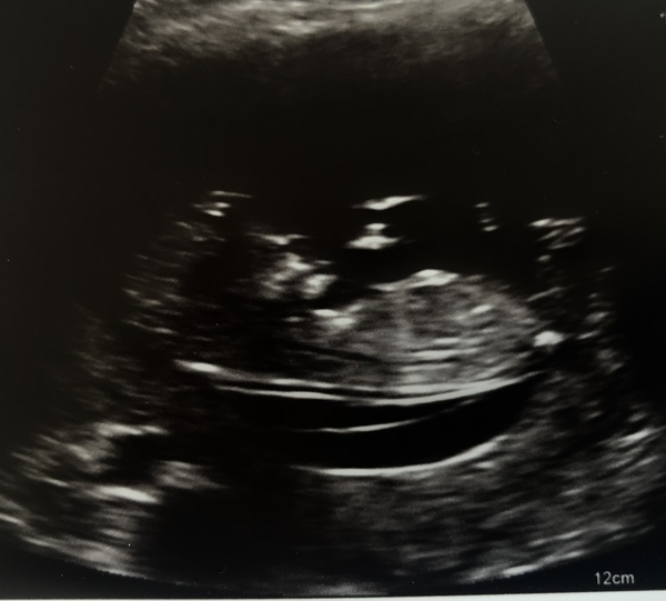 Just for fun... boy or girl?