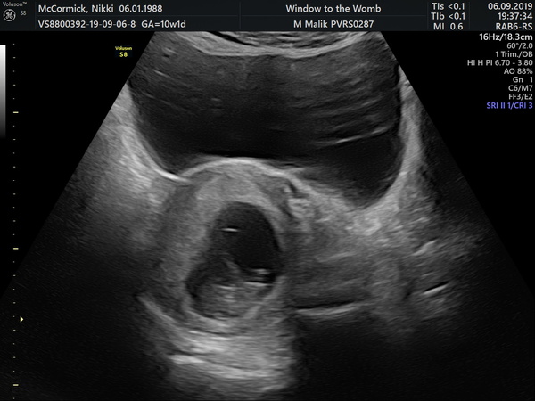 April 2020 Babies - Thread 2!