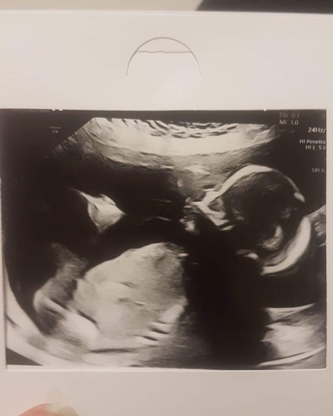 BFP - Anyone else feb 2020? Continued ...