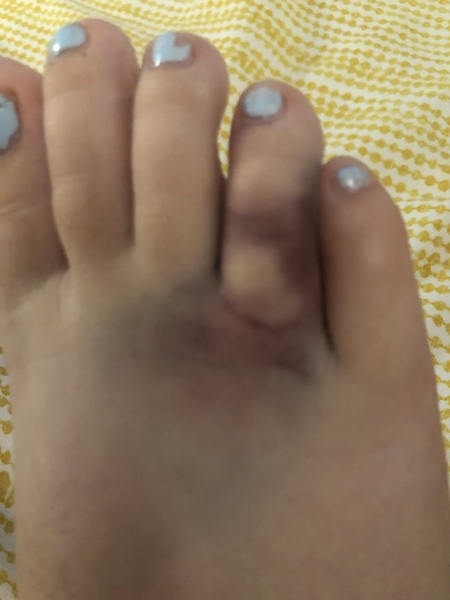 Broken?