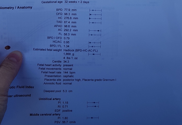 Small head, chunky tummy, consultant not worried