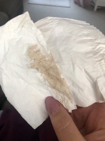 Implantation bleed?