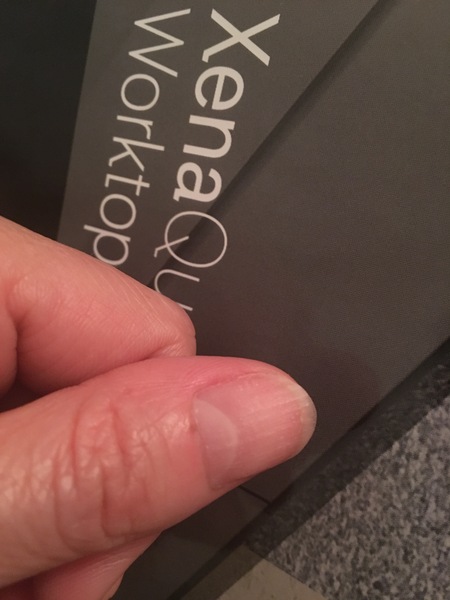 Does this dark patch on nail bed look like cancer to you ?