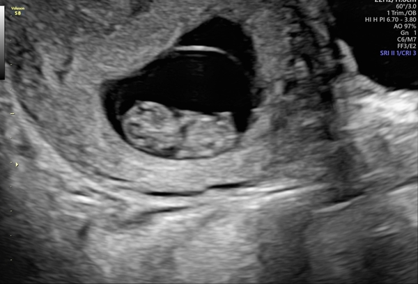 April 2020 Babies - Thread 2!