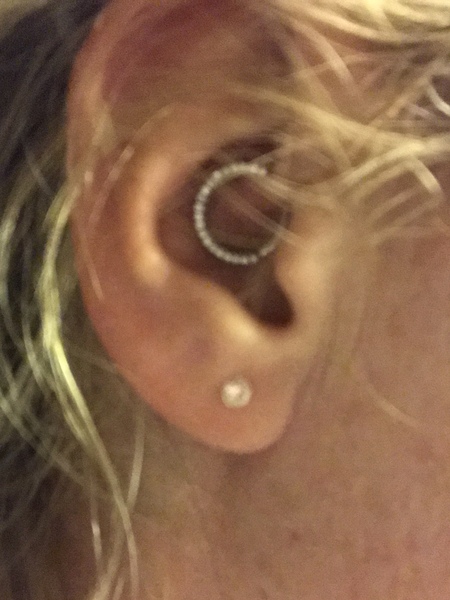 Migraines please help!!