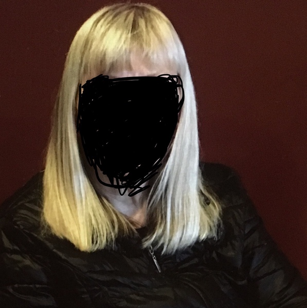 Hair loss along the hairline/front of the head.  Quite noticeable. I'm 42. WTAF?!