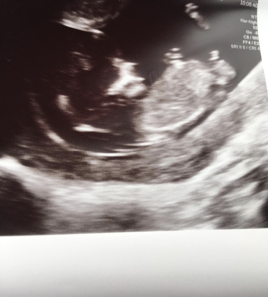 Is this a boy nub? Just for fun