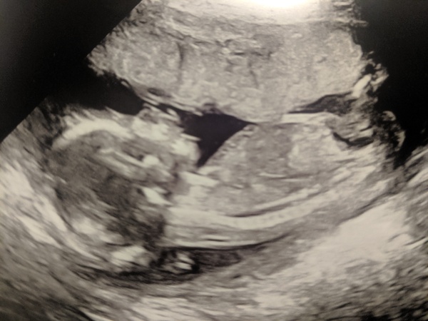 BFP - Anyone else feb 2020? Continued ...