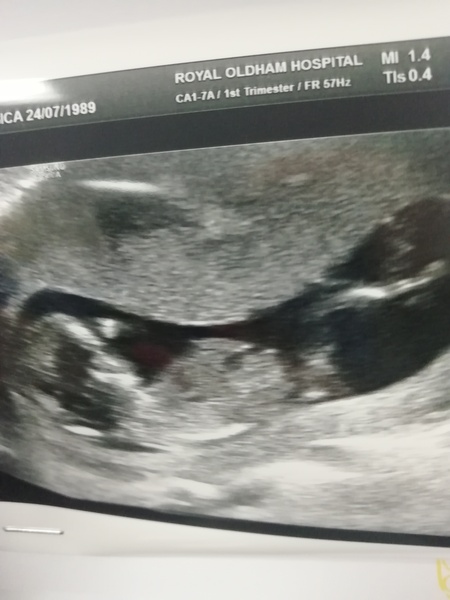 March Babies #3