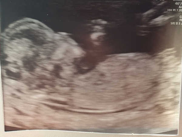 March Babies #3