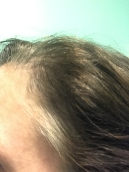 To embrace the grey?