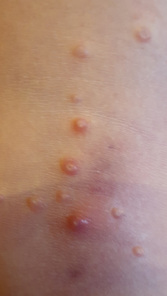 Any medical people about?