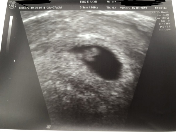 May 2020 babies