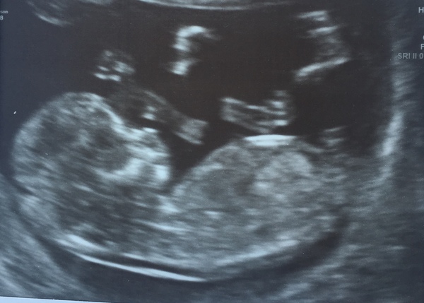 March Babies #3