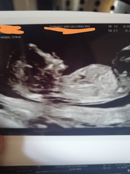 March Babies #3