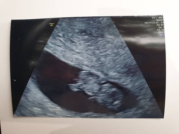 Due May 2020 - could do with a buddy!