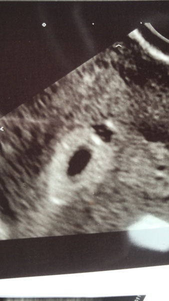 Possible twins!?