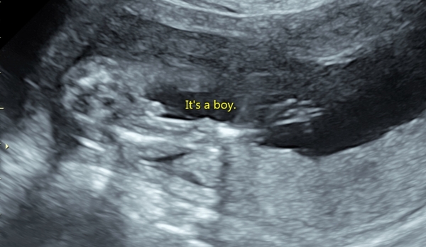 BFP - Anyone else feb 2020? Continued ...