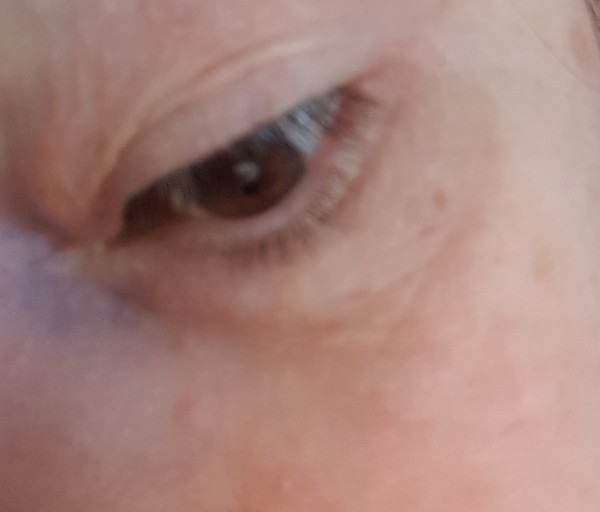When did you get your first line or wrinkle?