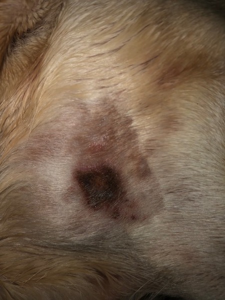 Allergic reaction to insect bite -- daily treatment advice pls