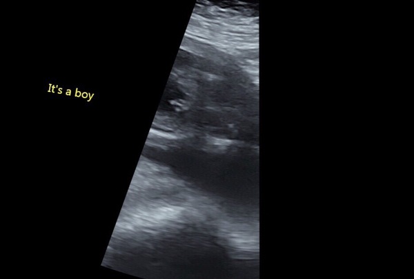 Potty shot confirmation
