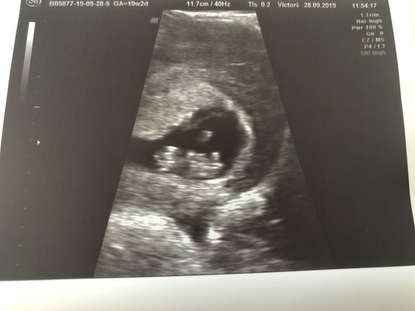 Due May 2020 - could do with a buddy!