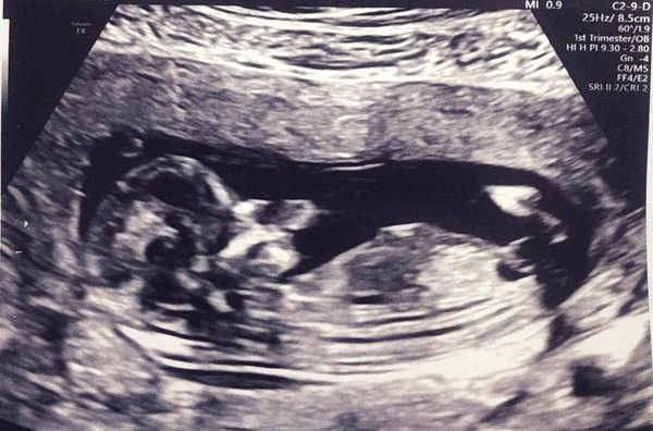 April 2020 Babies - Thread 2!