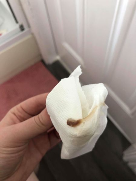 Bloody mucus 1 day after sweep. Expected or labour sign?