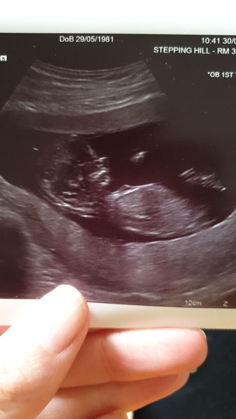 April 2020 Babies - Thread 2!