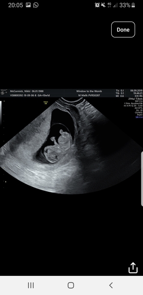 April 2020 Babies - Thread 2!