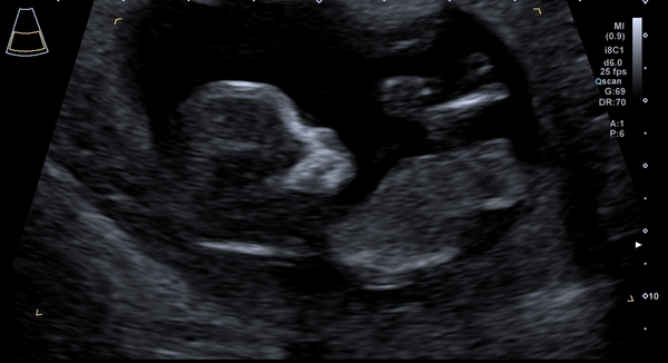 March Babies #3
