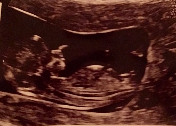 Graduates of the TTC After Pregnancy Loss thread. Aka: The Penguin Huddle