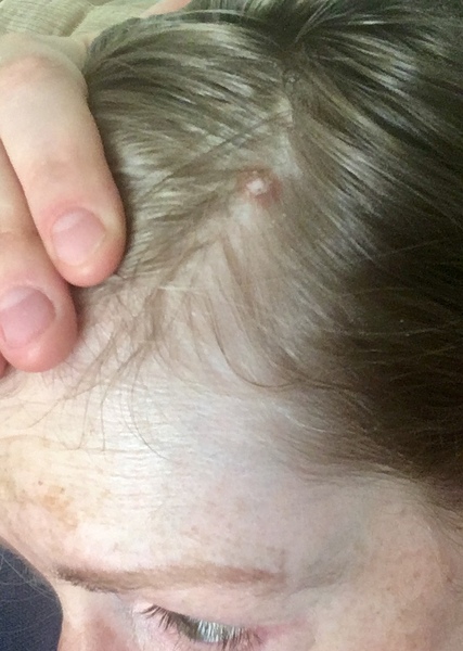 Do I really need to get this checked? Or paranoid hubby?!