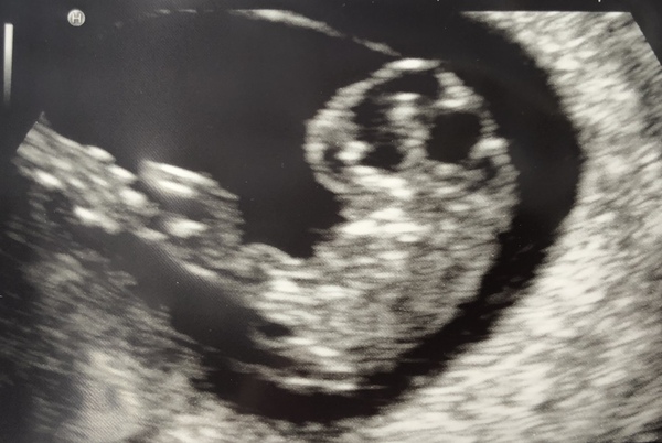 Graduates of the TTC After Pregnancy Loss thread. Aka: The Penguin Huddle