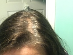 To embrace the grey?