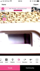 Asda pregnacy test pic - 11 DPO