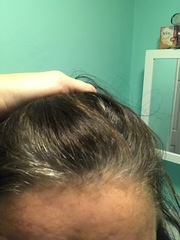 To embrace the grey?