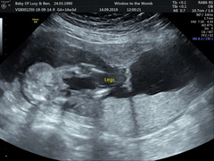 Is this definitely a boy?