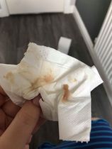 Bloody mucus 1 day after sweep. Expected or labour sign?
