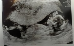 The Graduates of TTC after pregnancy loss thread #3 🐧🐧The Penguin Huddle 🐧🐧