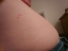 To be freaking out about bedbugs in premier Inn....