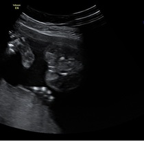 Potty shot - boy or girl?