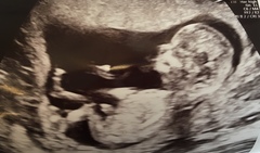 Graduates of the TTC After Pregnancy Loss thread. Aka: The Penguin Huddle