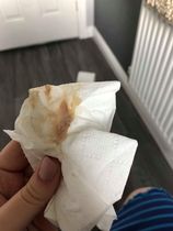 Bloody mucus 1 day after sweep. Expected or labour sign?
