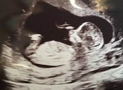 Graduates of the TTC After Pregnancy Loss thread. Aka: The Penguin Huddle