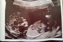 Graduates of the TTC After Pregnancy Loss thread. Aka: The Penguin Huddle