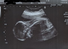 Graduates of the TTC After Pregnancy Loss thread. Aka: The Penguin Huddle